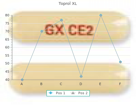 purchase toprol xl 100mg free shipping