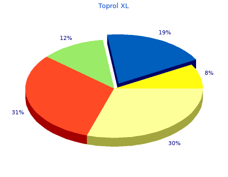 cheap toprol xl 25 mg without prescription